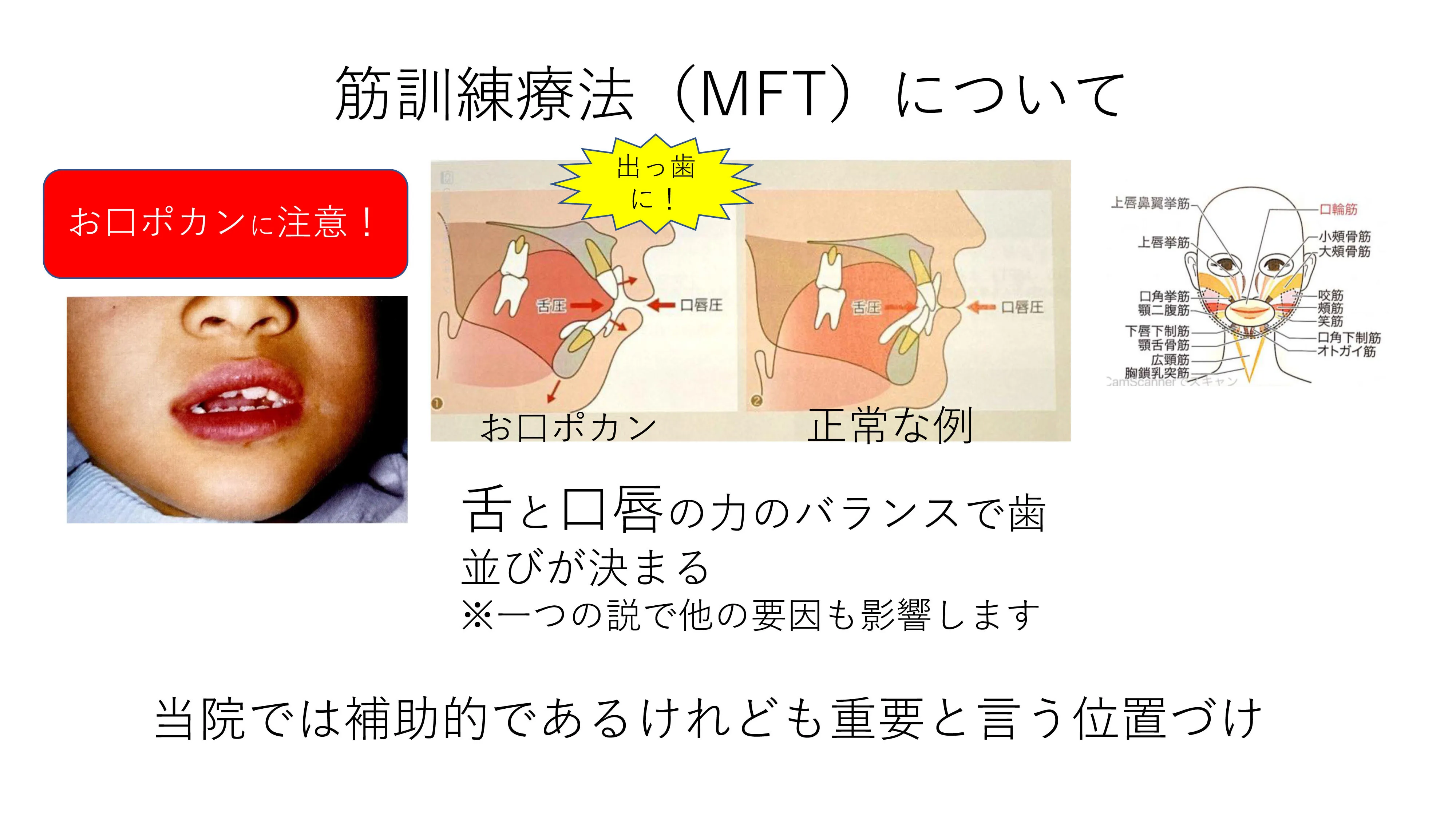 MFT