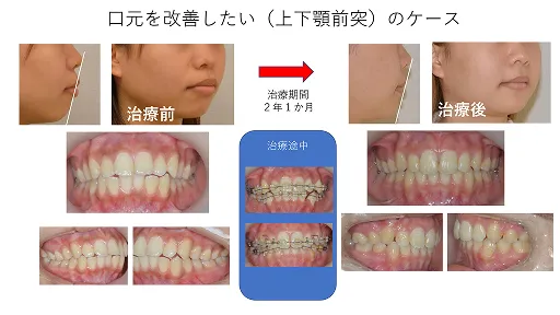 症例紹介