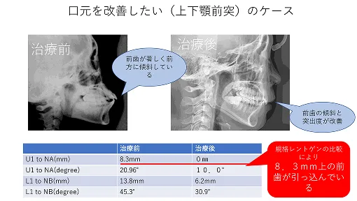 症例紹介