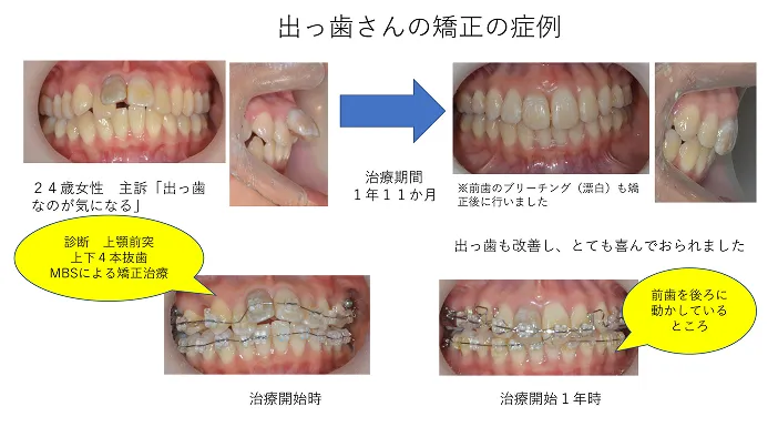 症例紹介