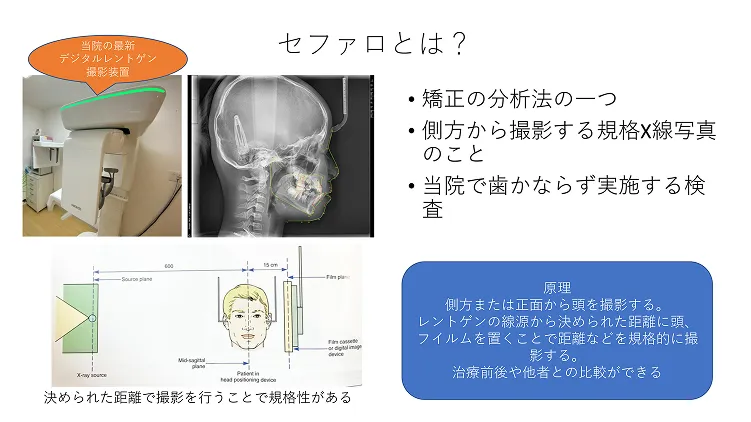 セファロ撮影