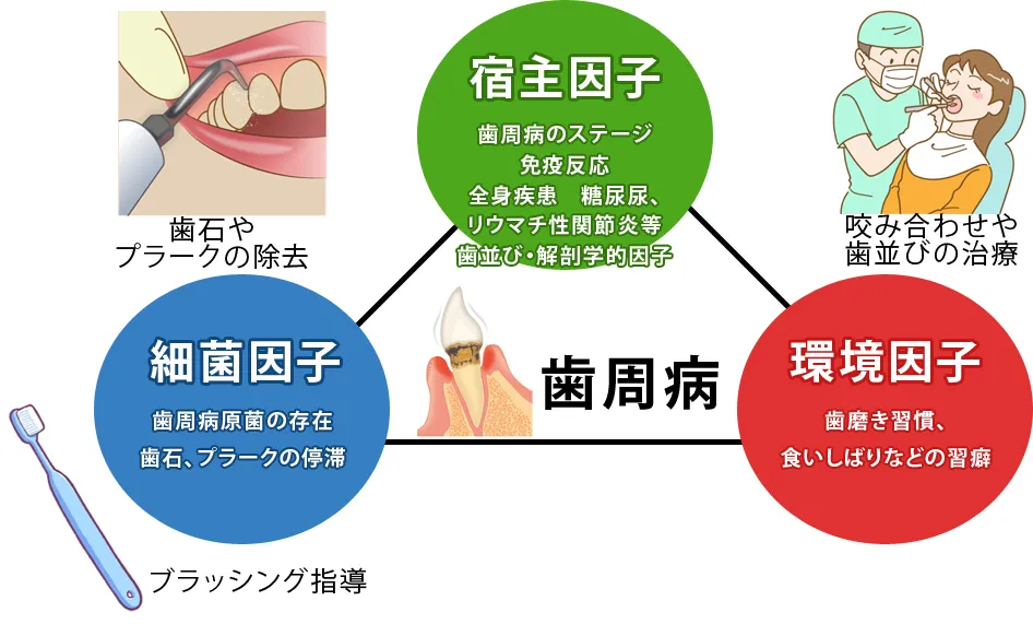 歯周病治療