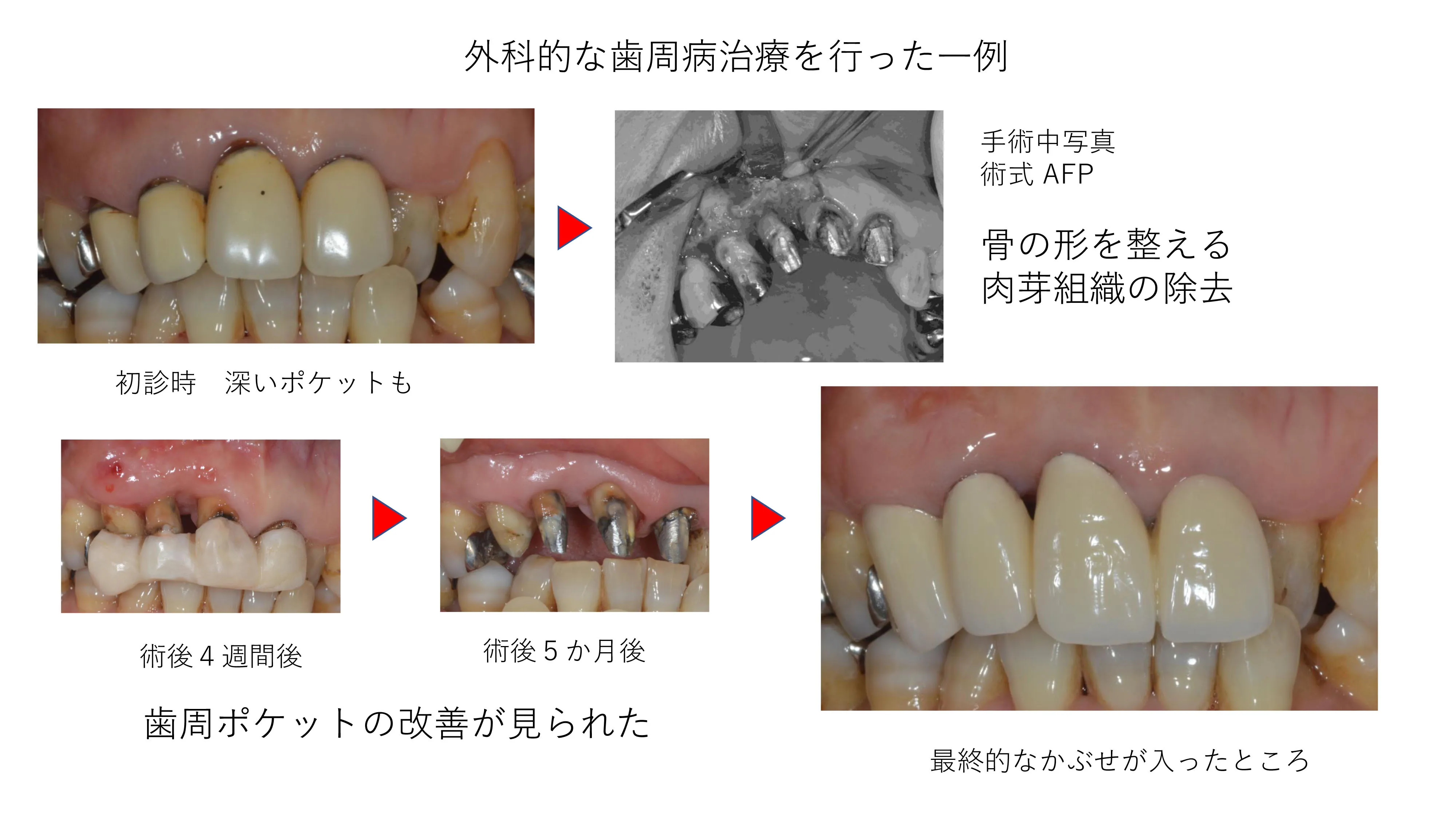 実際の治療例