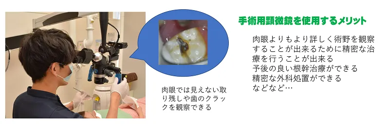 手術用マイクロスコープ