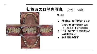 歯周外科