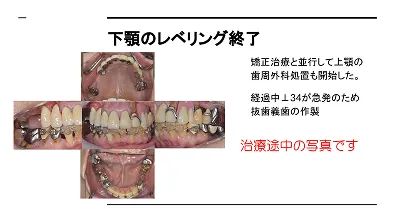 歯周外科