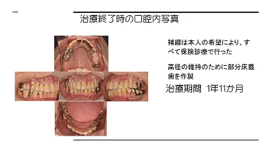 歯周外科