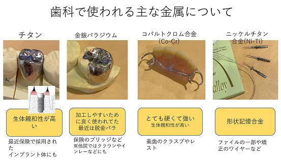 歯科治療で使用する代表的な金属と特徴